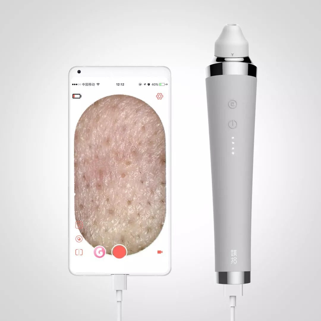 Xiaomi Youpin Visual Blackhead Beauty Apparatus